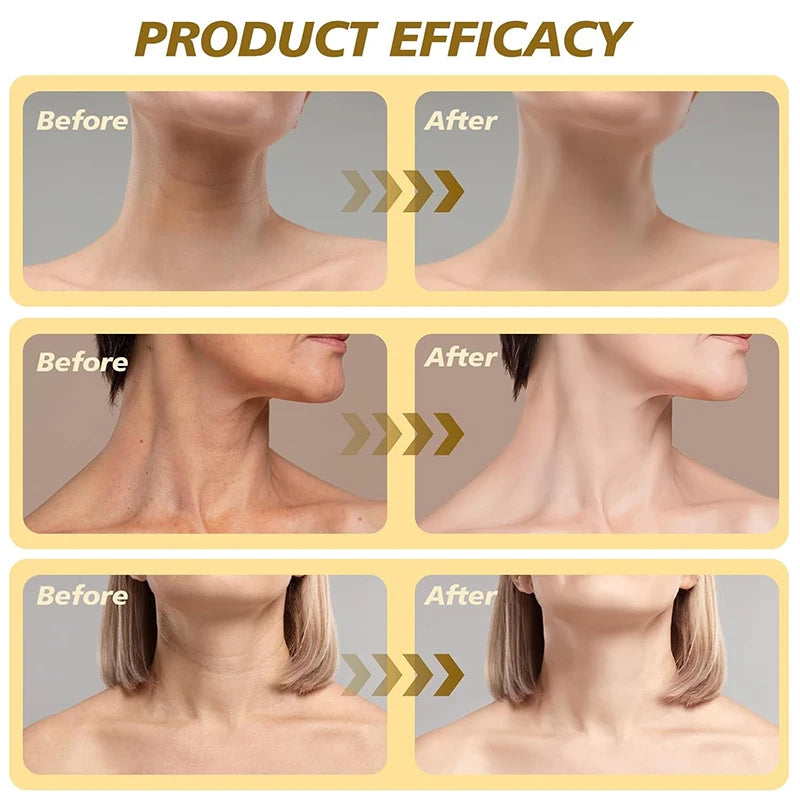 Neck Lifting Roller Lotion — Tighten, Nourish & Smooth